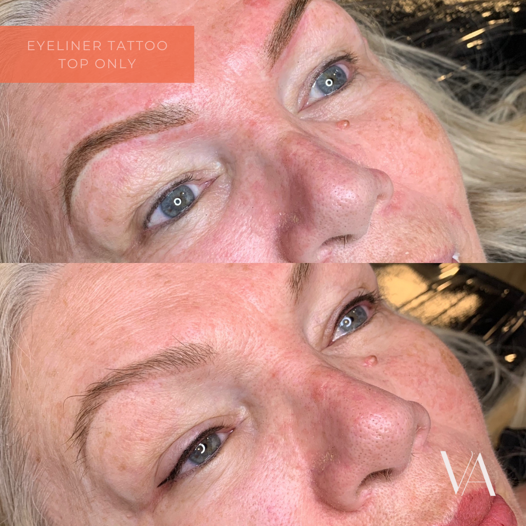 Before and After eyeliner lash enhancement cosmetic tattoo 