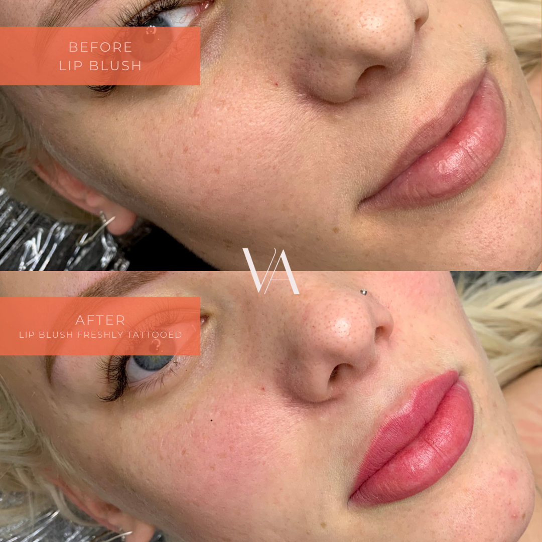 Before and after lip blush cosmetic tattoo 