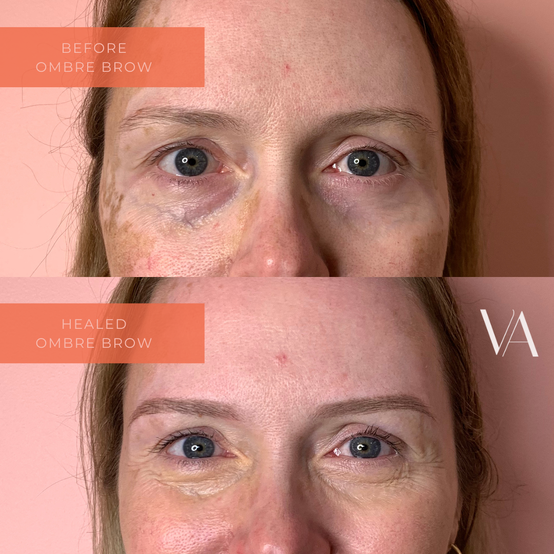 Before and after natural ombre brow cosmetic tattoo 