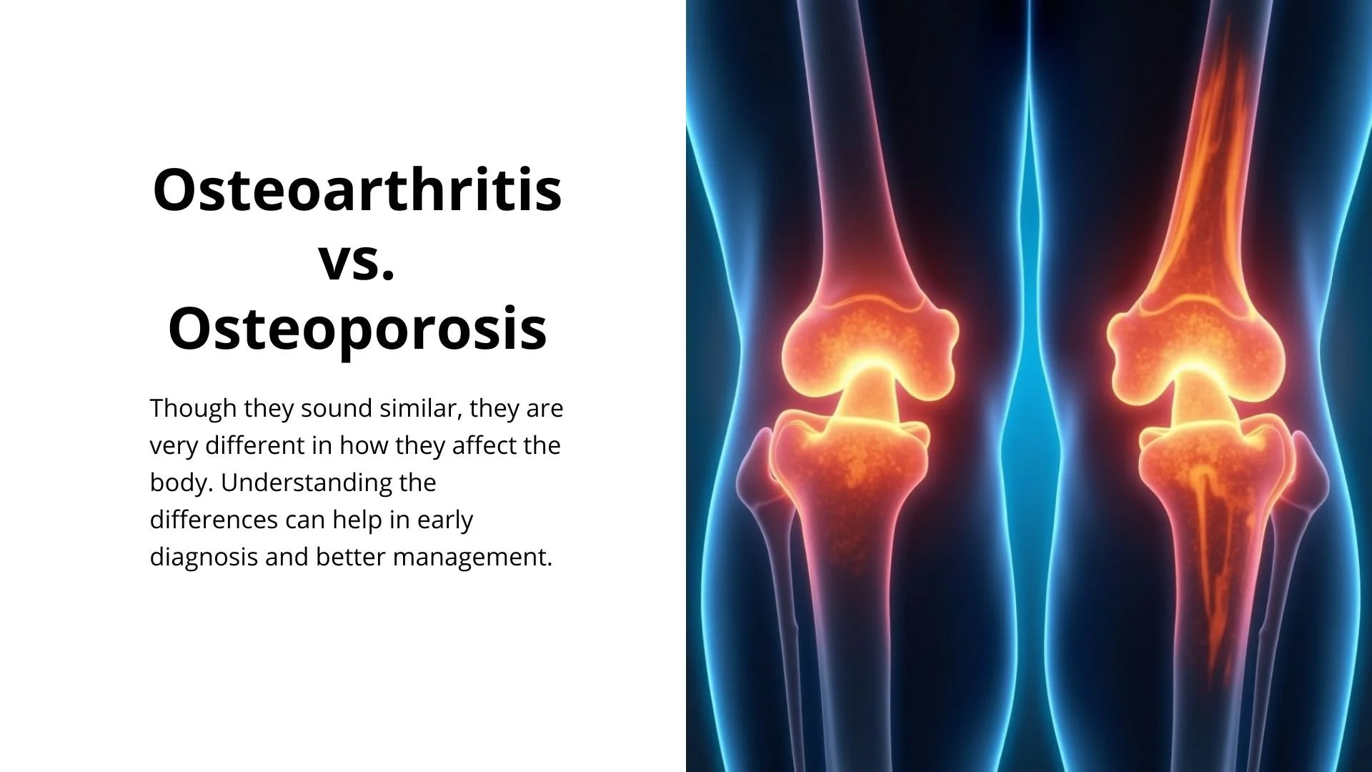 Osteoarthritis vs. Osteoporosis: What’s the difference?