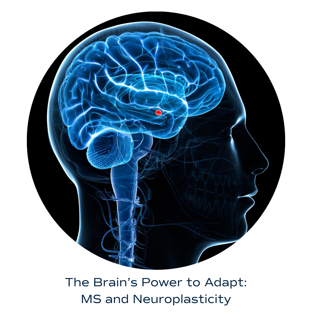 MS Workshop: The Brain’s Power to adapt: MS & Neuroplasticity