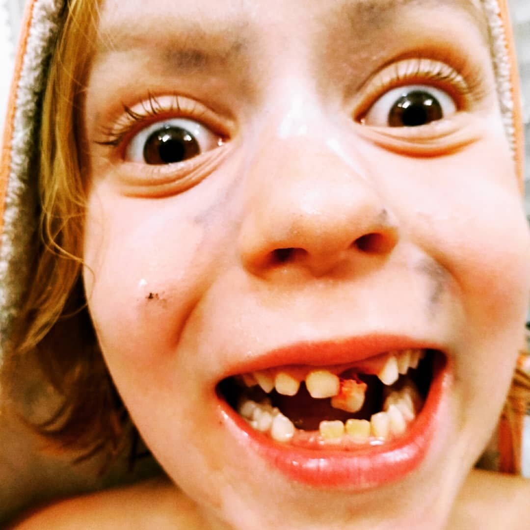 o tooth.jpeg