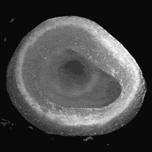 Animated image of 3D bioprinted heart ventricle beating by Fluidform Regenerative Medicine