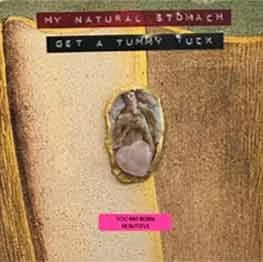 My Natural Stomach (Get a Tummy Tuck)