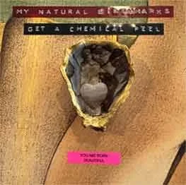 My Natural Birthmarks (Get a Chemical Peel)