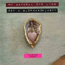 My Natural Eyelids (Get Blefaroplasty)