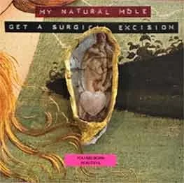 My Natural Mole (Get a Surgical Excision)