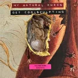 My Natural Knees (Get Coolsculpting)