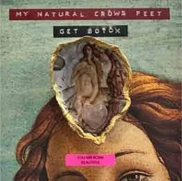 My Natural Crows Feet (Get Botox)