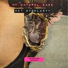 My Natural Ears (Get Otoplasty)