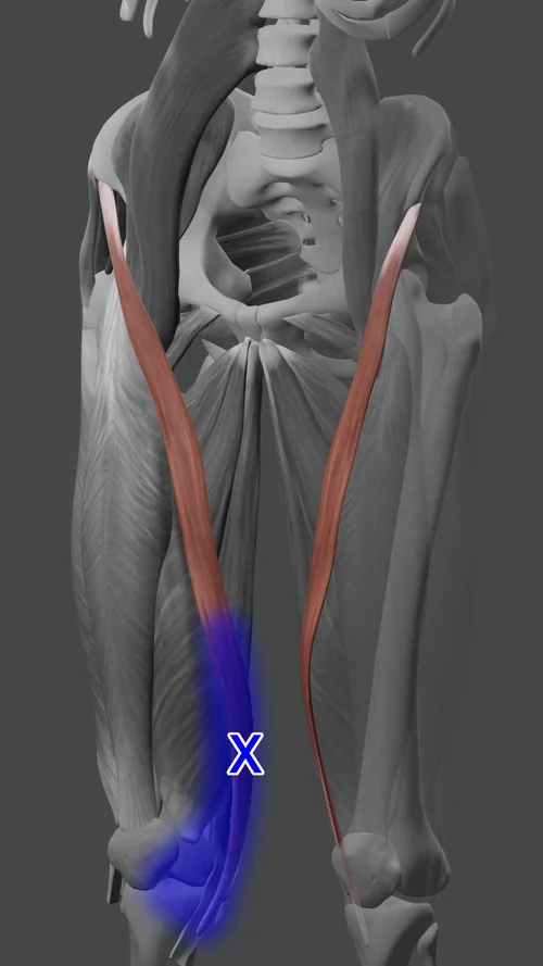 Acupuncture for Sartorius Muscle Pain — Morningside Acupuncture NYC