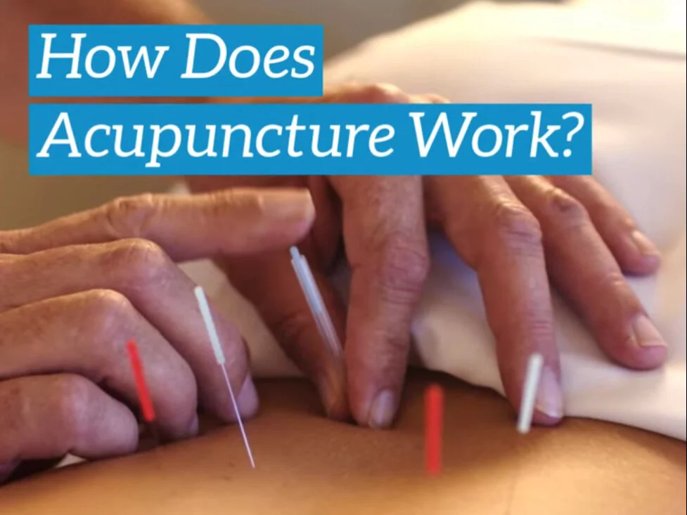 About Acupuncture — Morningside Acupuncture NYC
