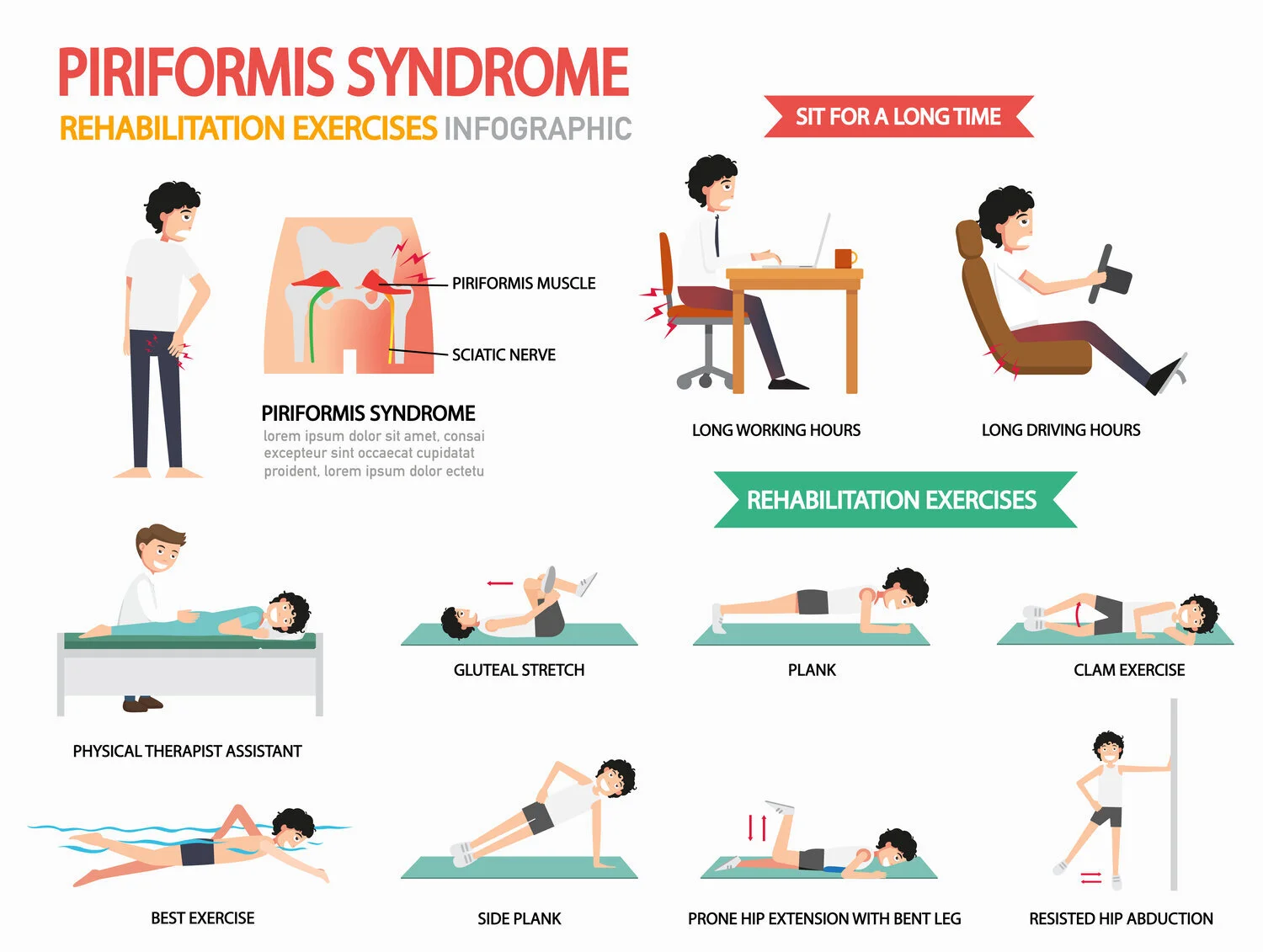 Acupuncture for Sciatica — Morningside Acupuncture NYC