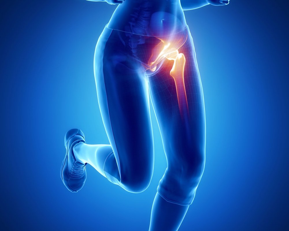 What is Hip Impingement? — Morningside Acupuncture NYC
