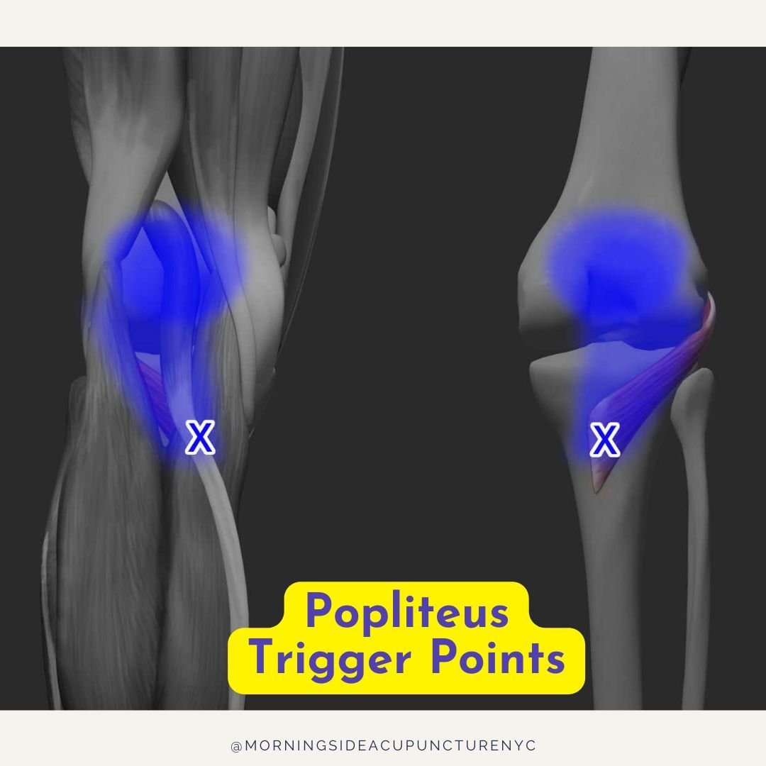 🦵Struggling with knee pain during sports? The popliteus muscle tends to get overloaded when stopping forward motion while performing a twisting turn on a bent knee on that side. This is a common movement in soccer and football. ⁠
⁠
Learn more about 