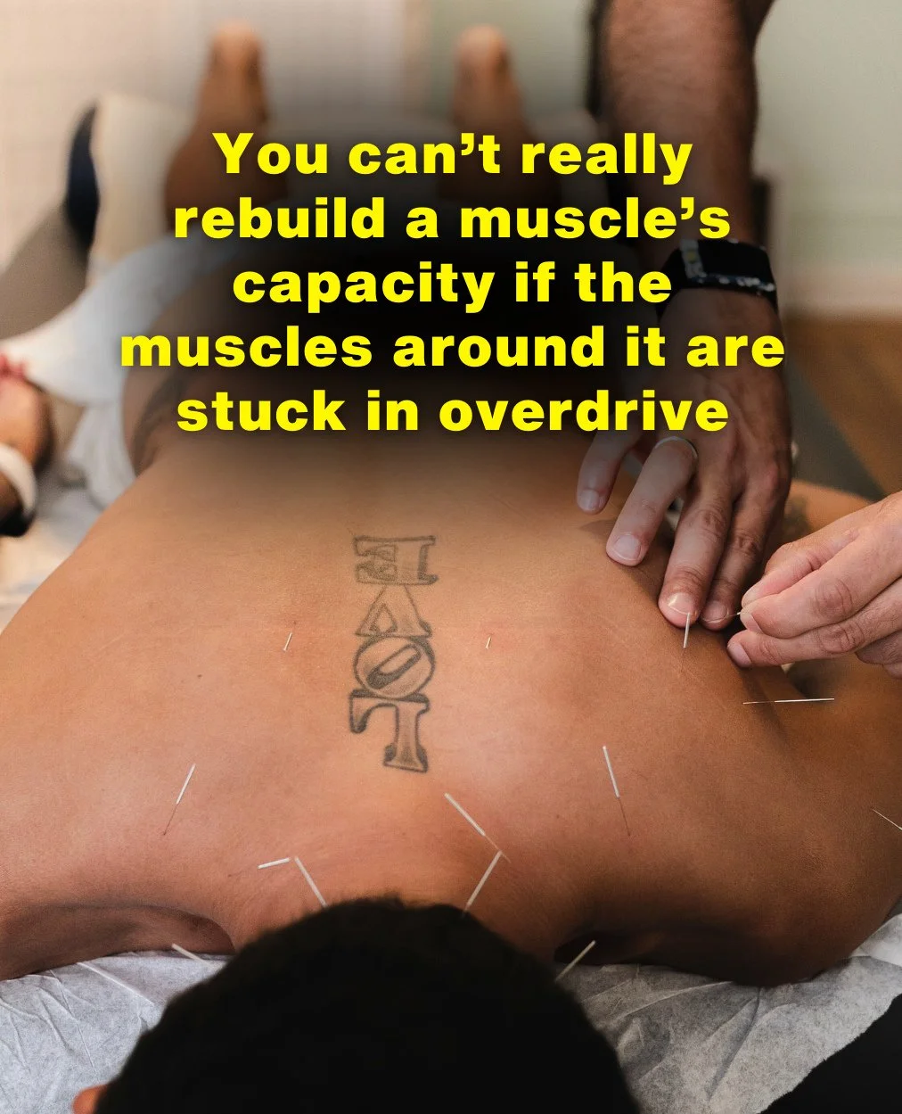 If your strength keeps plateauing, this is why: you can&rsquo;t really rebuild a muscle&rsquo;s capacity if the muscles around it are stuck in overdrive. When those neighbors are clamped with trigger points, your body rides the brake 🛑.⁠
⁠
We see th