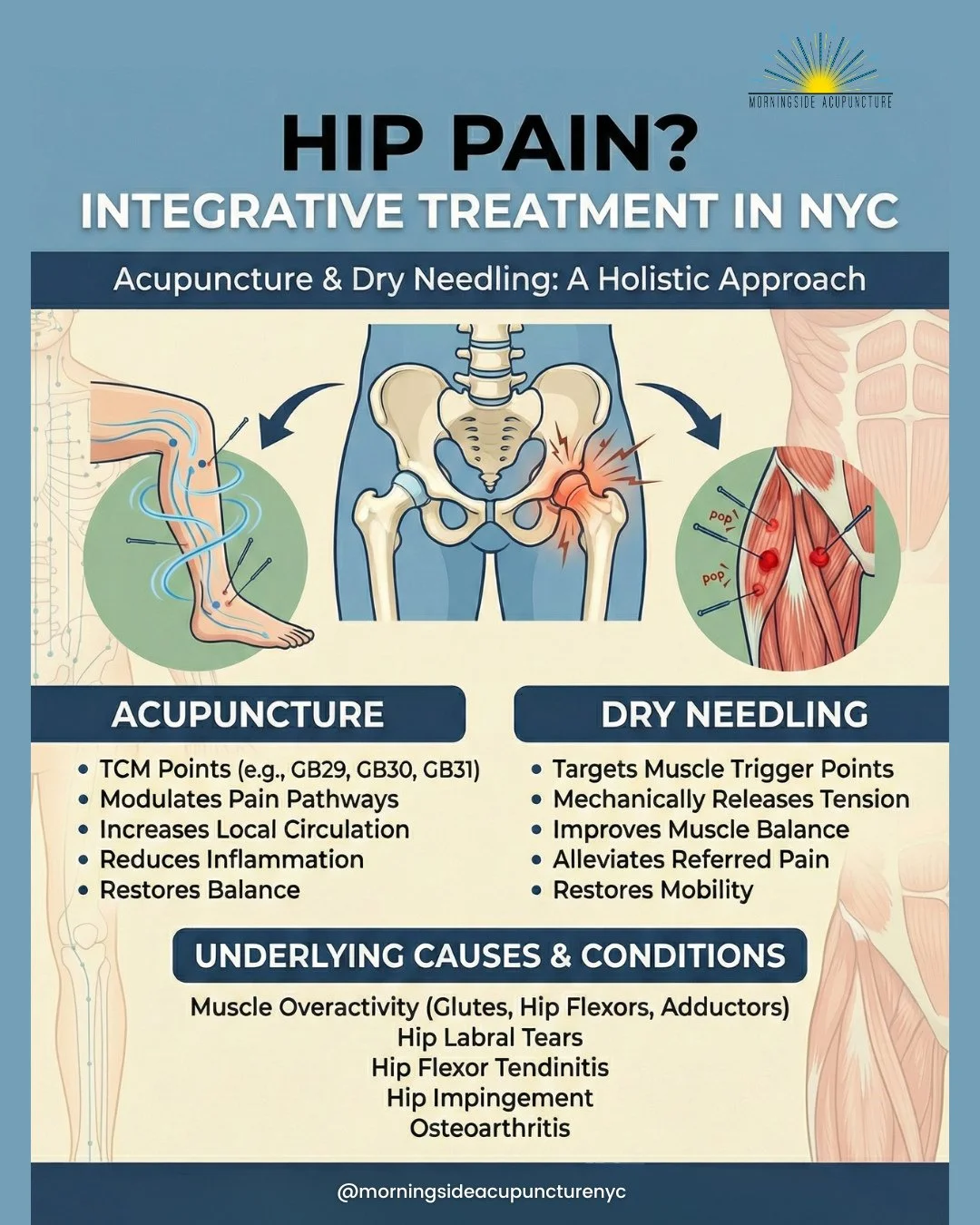 If your hips feel 80 but your ID says 28, this is for you. 🪪⁠
⁠
Hip pain isn&rsquo;t just a tight hip flexor. It can be arthritis, bursitis, labral irritation, or sciatica-like referral pain. 🦵⁠
⁠
The New York grind: subway seats, desk marathons, w