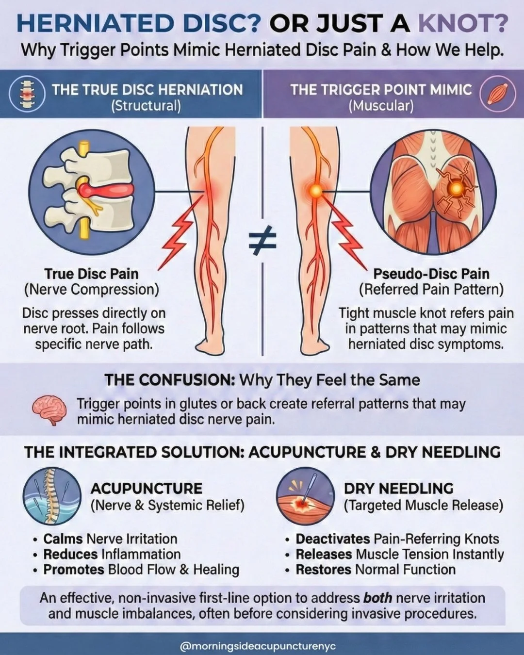 That "sciatica" pain might not be what you think it is. 🤯⁠
⁠
It&rsquo;s shocking how often a stubborn trigger point in the glute or lower back can mimic the symptoms of a herniated disc. The pain path is the same, but the cause is differen
