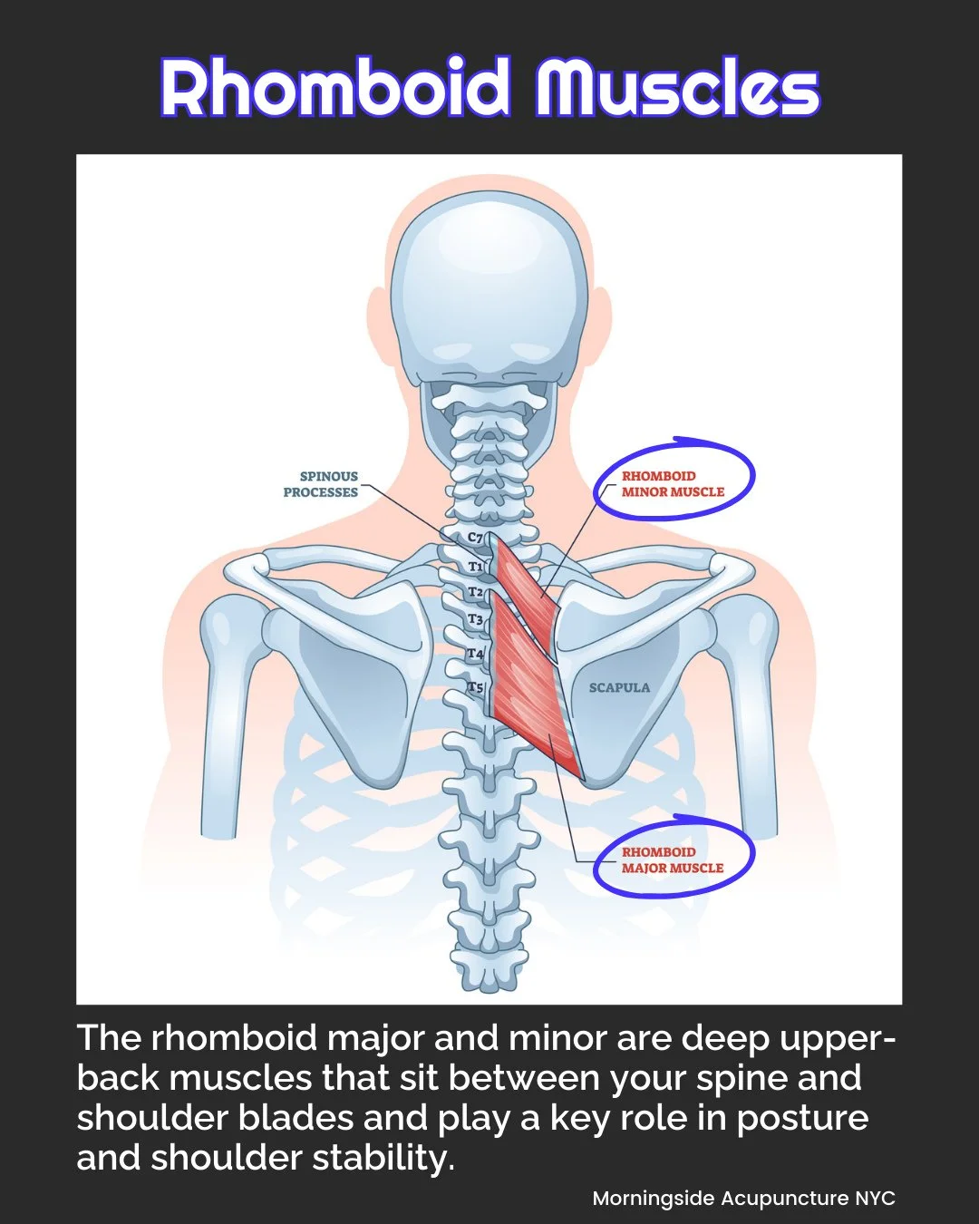 That deep ache between your shoulder blades could be rhomboid trigger points quietly creating ongoing upper-back pain, stiffness, and even shoulder discomfort.⁠
⁠
Common causes of rhomboid trigger points:⁠
&bull; Forward shoulder posture⁠
&bull; Repe