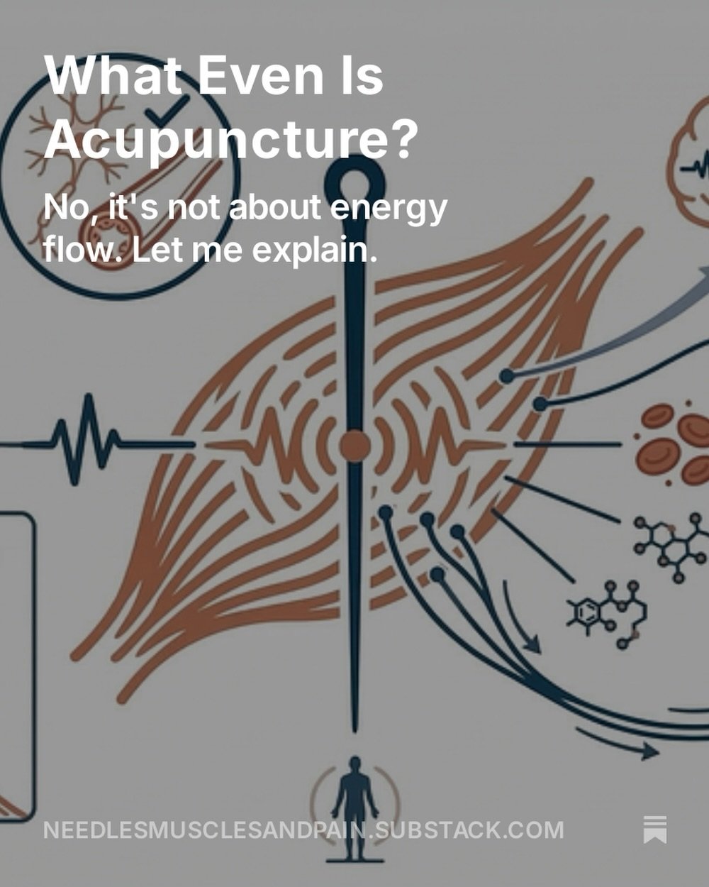 So&hellip; what even is acupuncture? 🤔

If you asked ten people, you&rsquo;d get ten different answers. Energy flow. Chakras. Something about being a human pincushion.

Most of those answers are wrong.

Here&rsquo;s the real answer: acupuncture is t