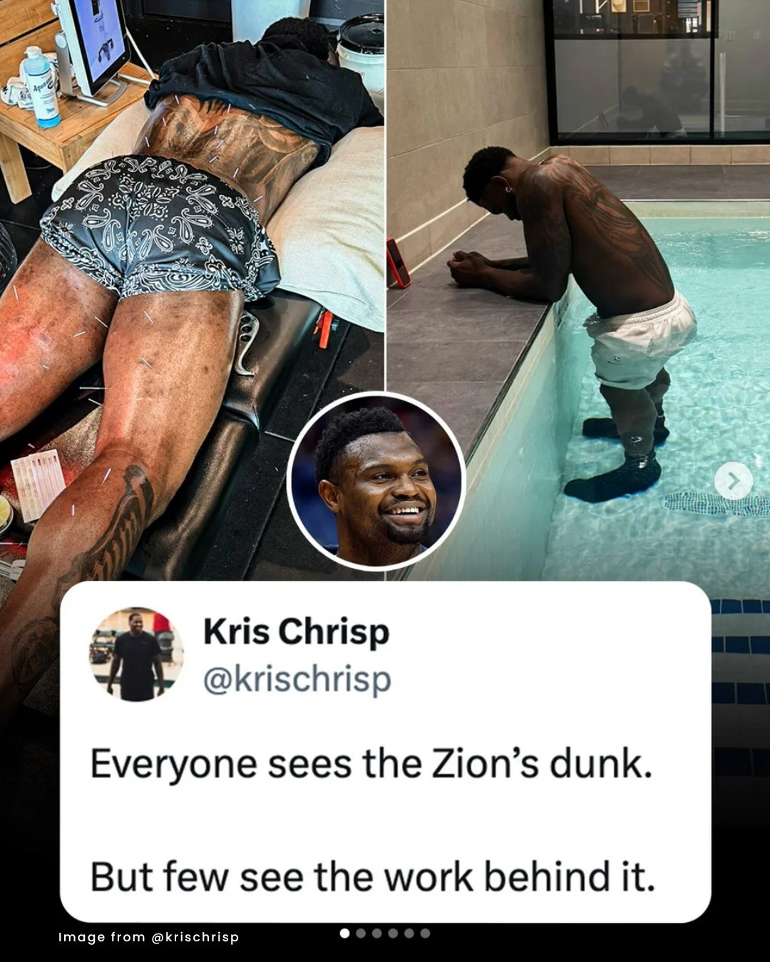 When top athletes like NBA Forward Zion Williamson trust needles, you know they&rsquo;re onto something. 🏀 ⁠
⁠
From acupuncture to dry needling, pros are using targeted needling to keep their bodies performing at the highest level. This approach giv