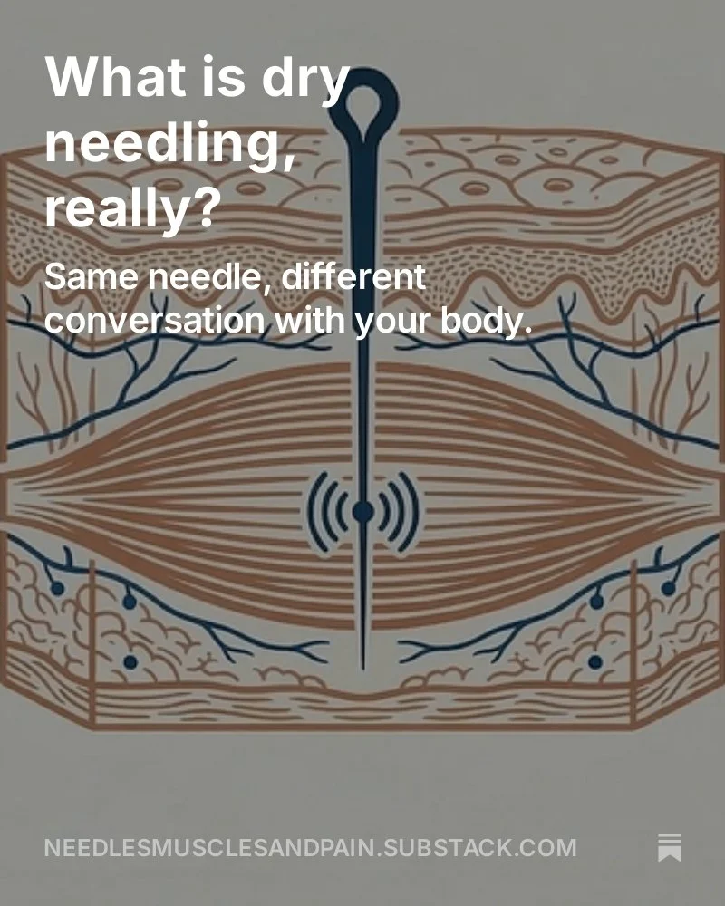 So what is dry needling, really?

It uses an acupuncture needle. Nothing is injected. The "dry" part just means: no medication, no saline, no anesthetic. Just the needle going into muscle tissue.

Here's where it gets interesting: dry needl