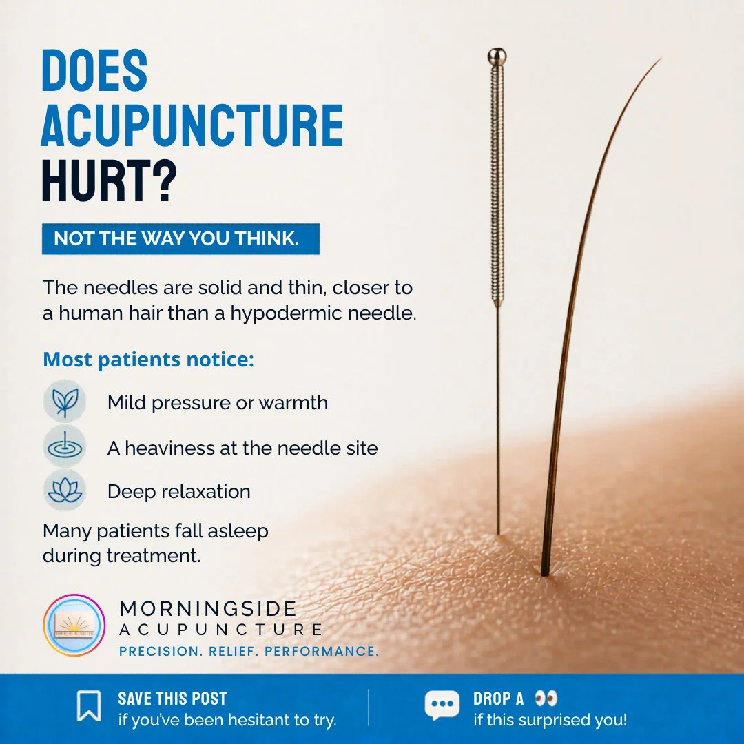 Most people who are nervous about acupuncture are picturing a hypodermic needle. That's not what we use.⁠
⁠
Acupuncture needles are solid, flexible, and about the width of a human hair. Most patients don't feel the insertion at all. What they notice 