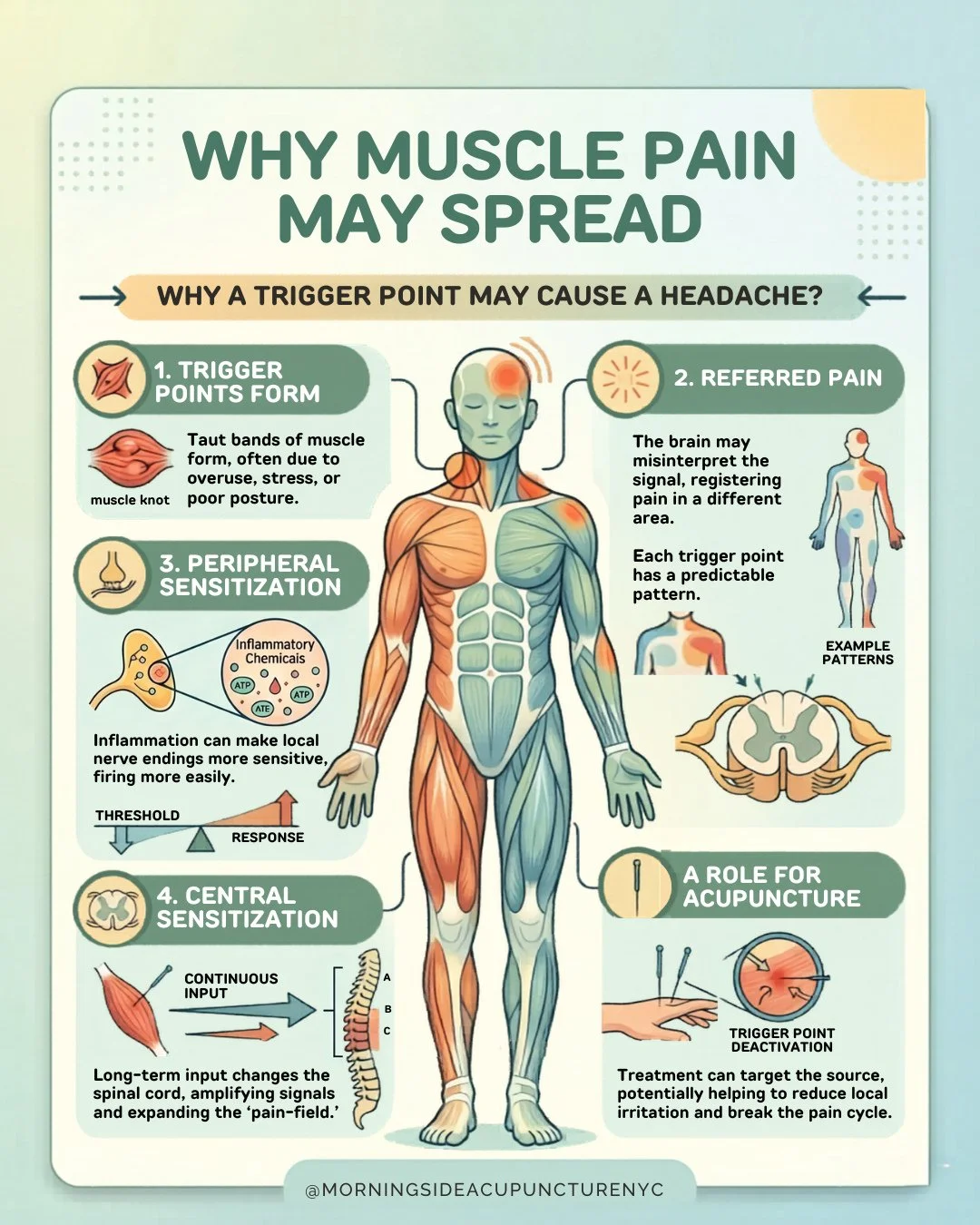 Understanding how referred pain, peripheral sensitization, and central sensitization interact helps explain why chronic pain can feel so unpredictable and why treating the source matters.⁠
⁠
Acupuncture and dry needling may help deactivate trigger po