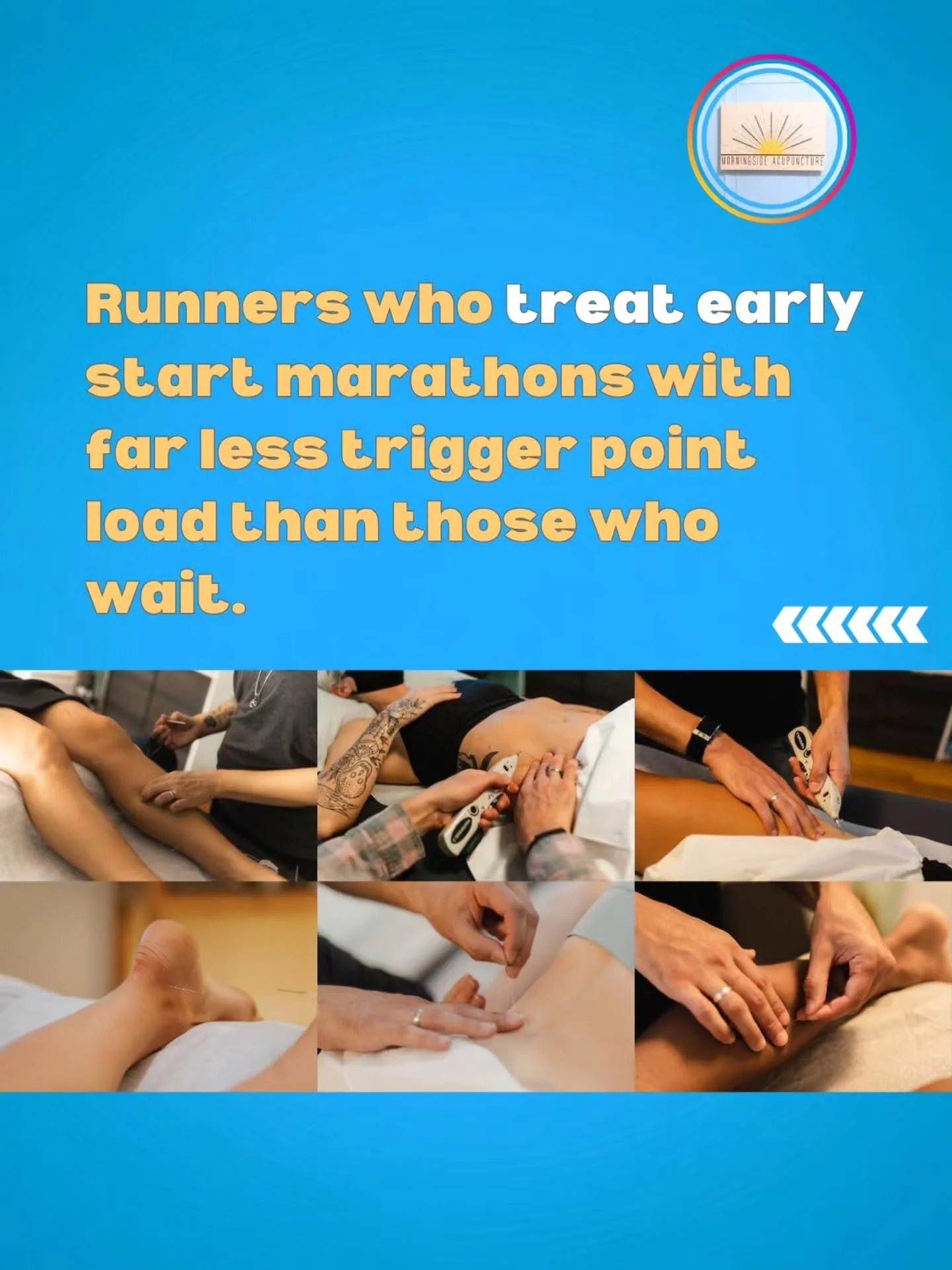Runners who stay ahead build treatment into their plan. This looks like dry needling from weeks 6-10 to catch trigger points before they escalate, treatment for anything that flares up along the way, and 1-2 sessions during the taper.⁠
⁠
Rest alone w