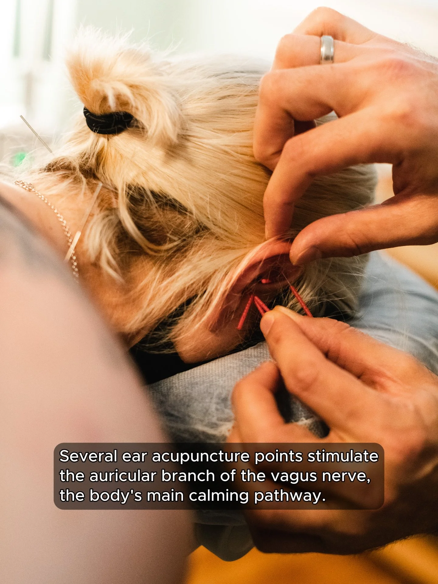 One reason ear acupuncture is often paired with neck and shoulder work for stress is that several points on the ear sit along the auricular branch of the vagus nerve, the nerve most responsible for shifting your body out of fight-or-flight.⁠
⁠
Resear
