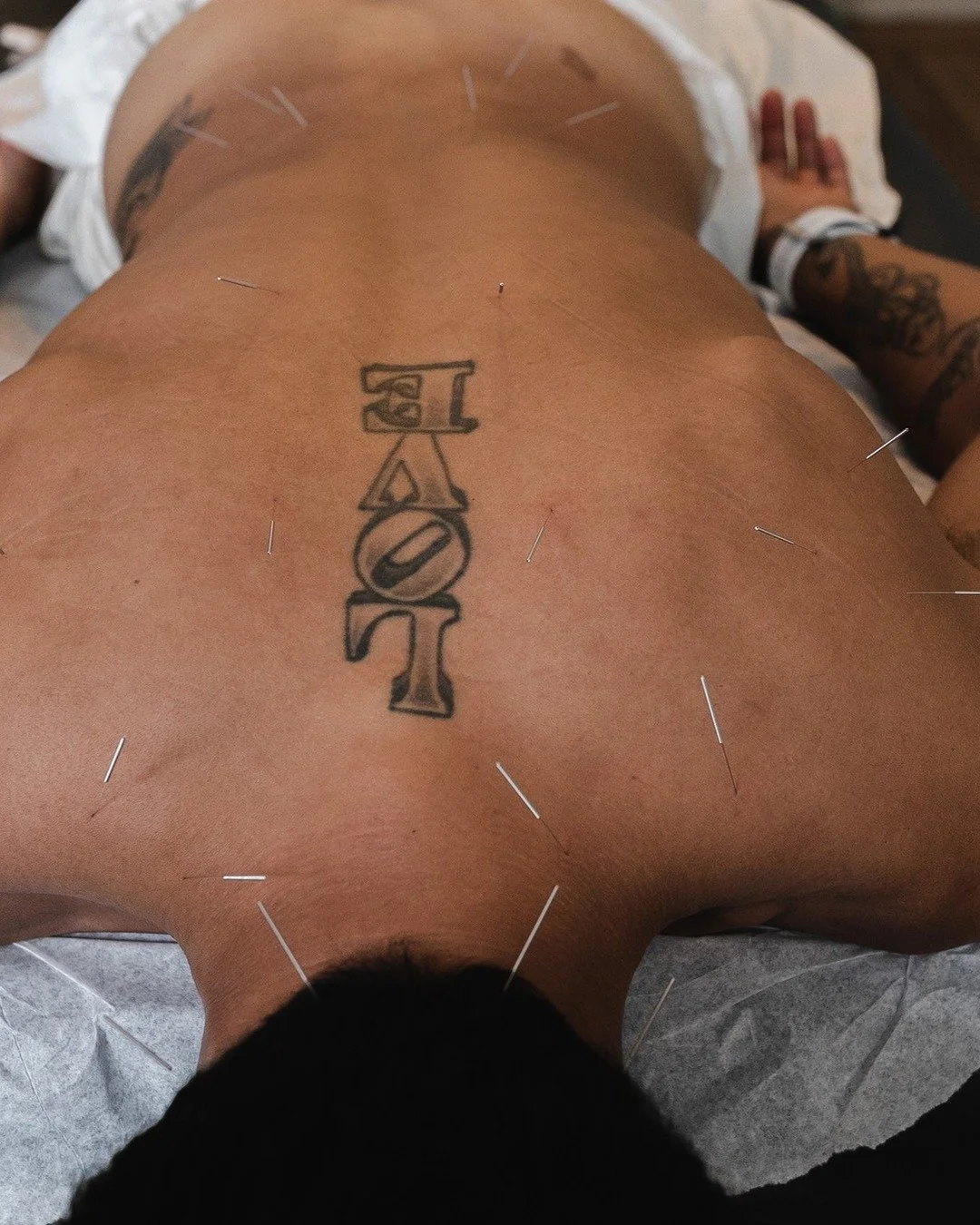 Why does muscle pain spread?

It started in one spot. Now it is in three. A few things can cause that:

&bull; Referred pain: a trigger point in one muscle sends pain to another area
&bull; Compensation: you move differently to protect the sore spot,