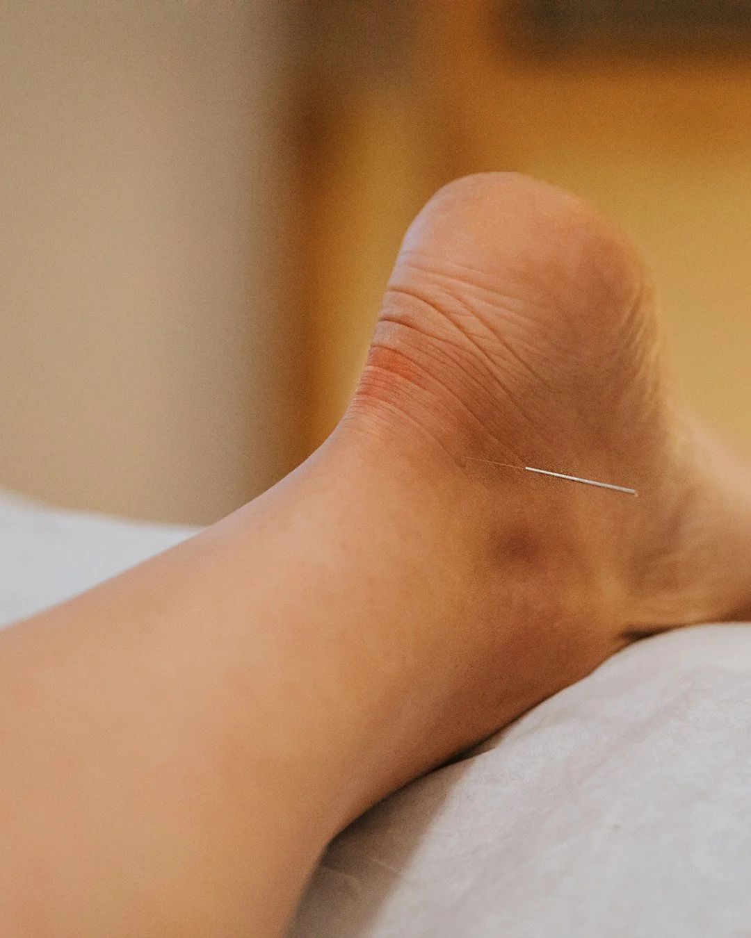 Runners: heel pain is not always a foot problem.

Trigger points in the soleus, the deep calf muscle, commonly refer pain to the heel and the Achilles. After 26.2 miles, the calves are one of the first places we look.

Other patterns we see in runner