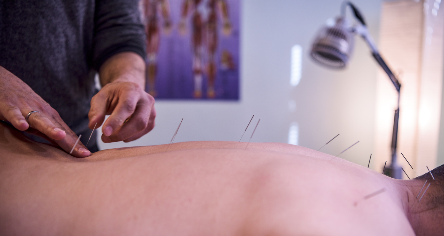 Acupuncture for Sartorius Muscle Pain — Morningside Acupuncture NYC
