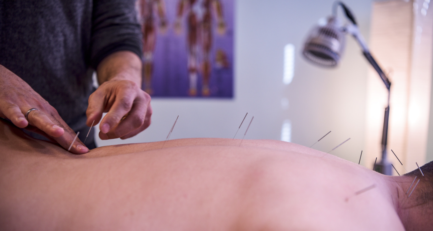 Chelsea Acupuncture, London