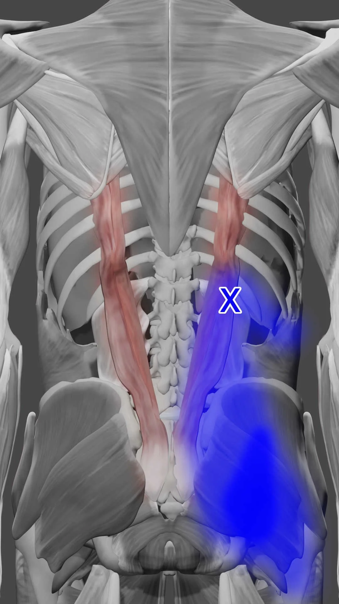 Iliocostalis Lumborum muscle trigger points
