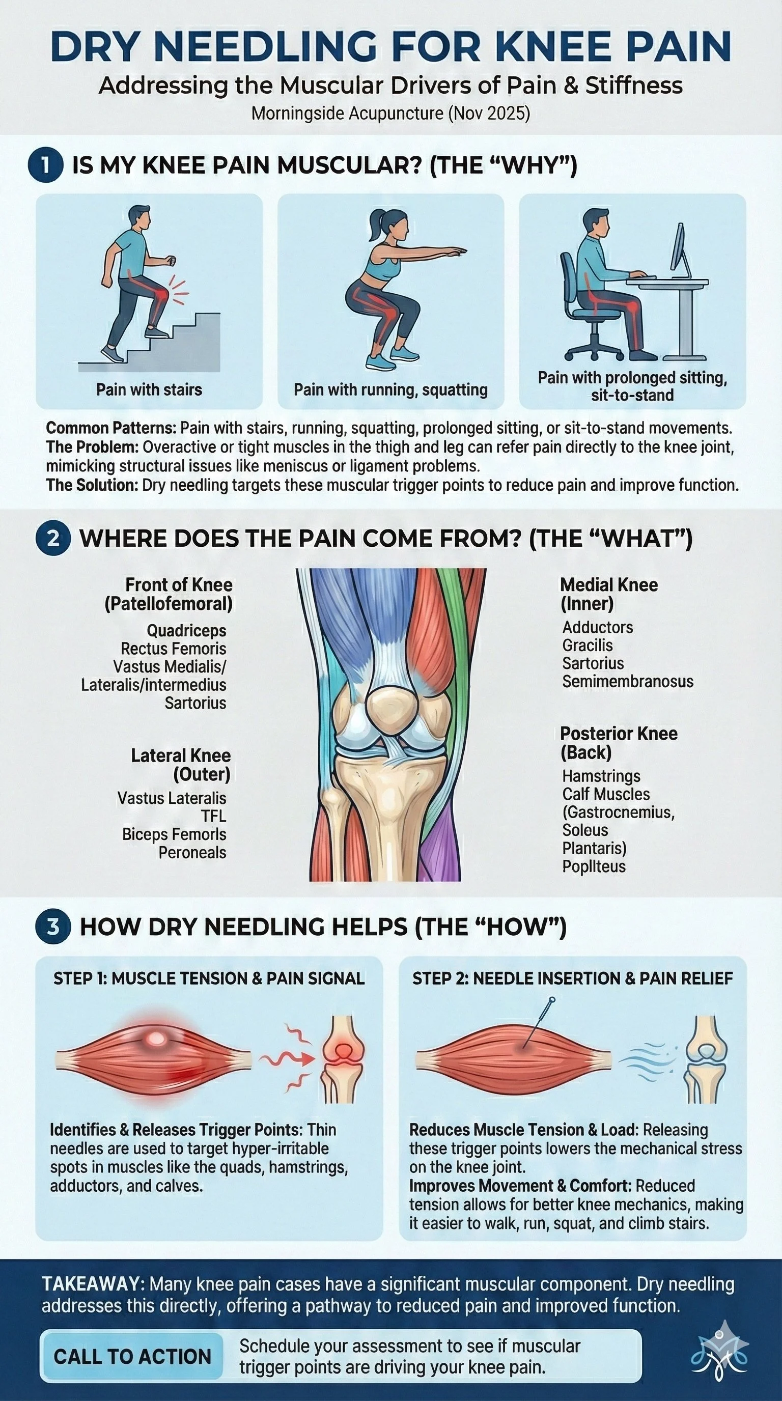 Dry needling for Knee Pain