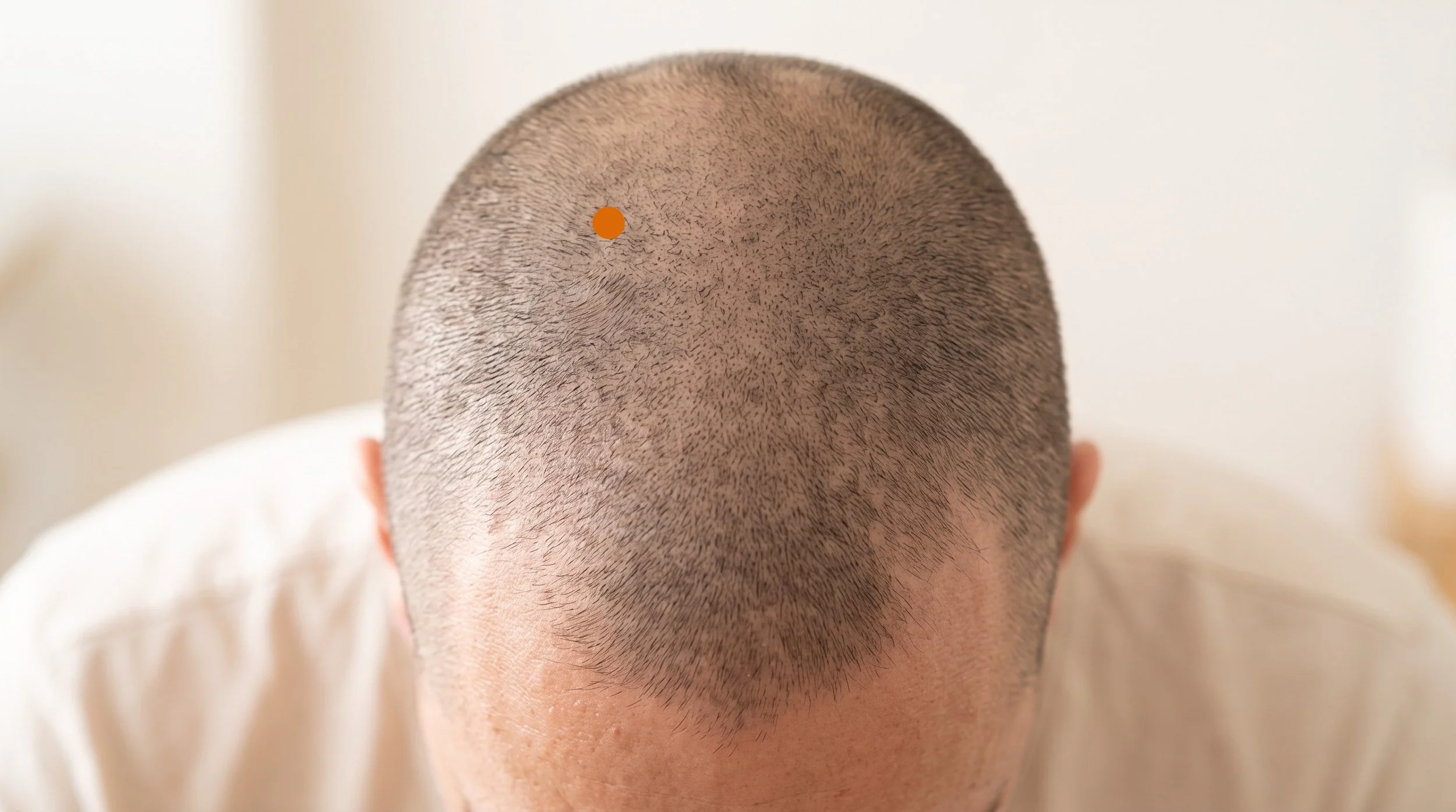 BL8 Acupuncture Point (Luoque)