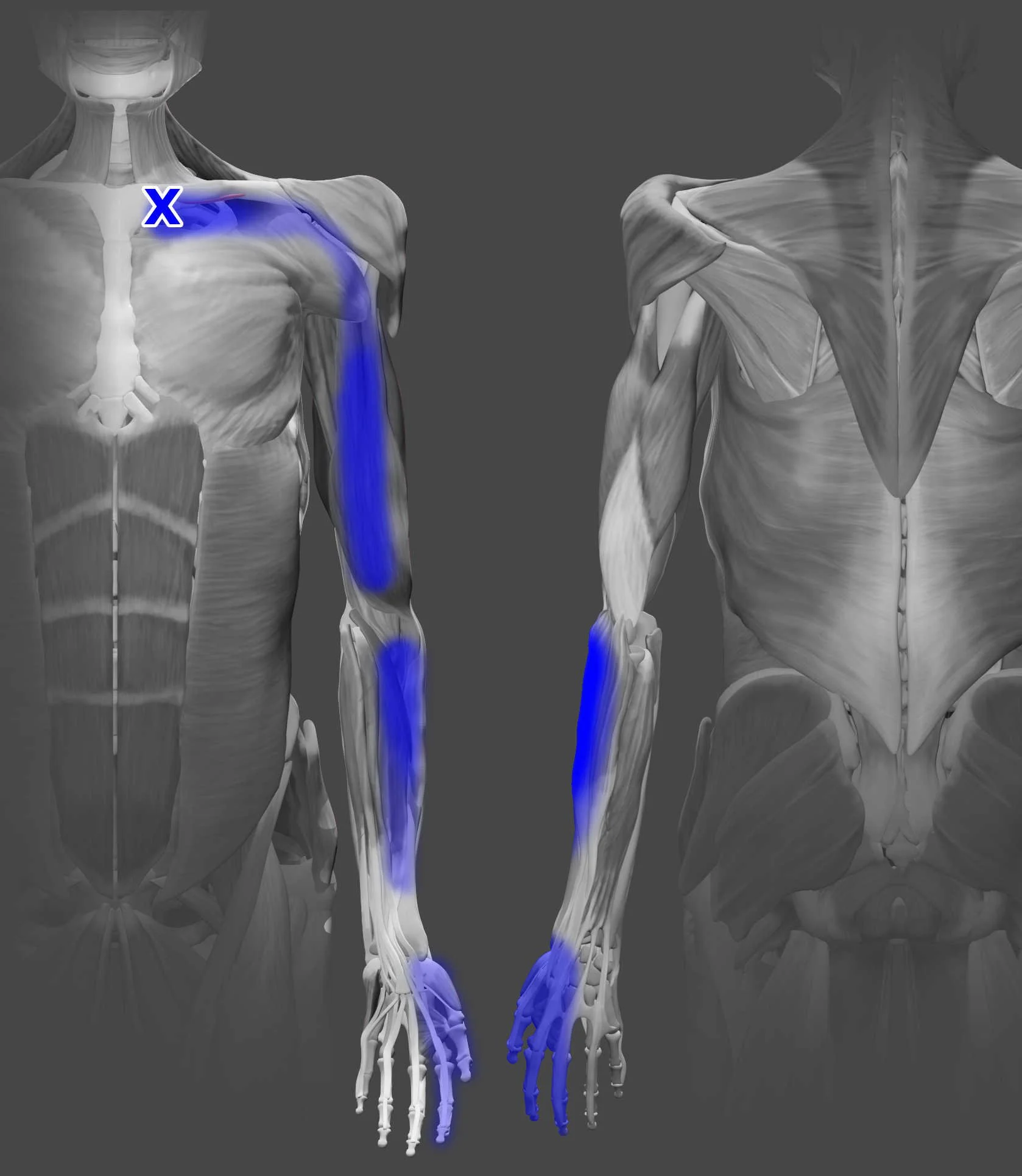 Subclavius trigger points