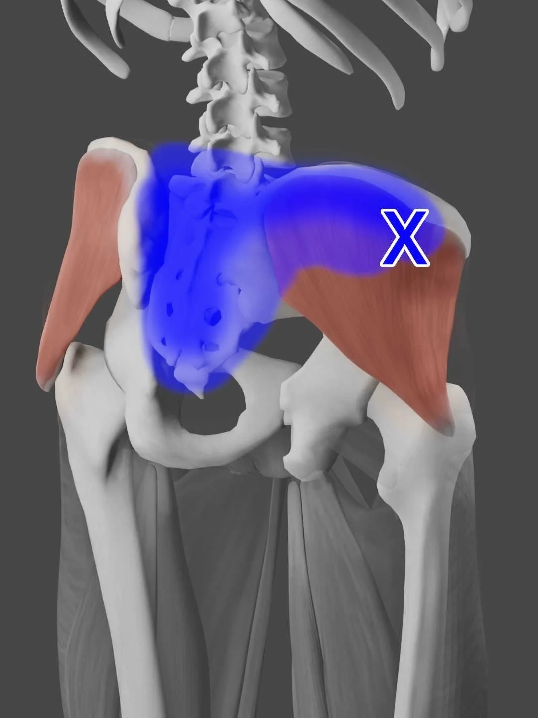 Trigger Point Sacrum Acupuncture for Gluteus Medius Pain — Morningside Acupuncture NYC