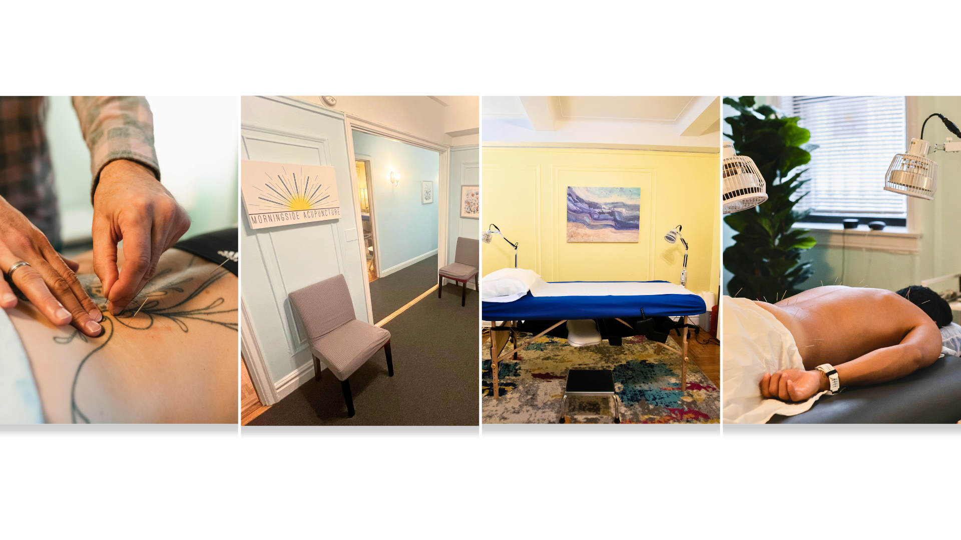 Sciatica Treatment NYC | Relieve Pain with Acupuncture — Morningside ...