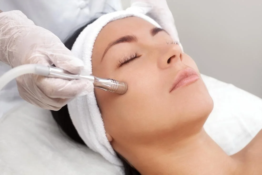 MICRONEEDLING, MICRODERMABRASION AND DERMAPLANING LONDON ONTARIO