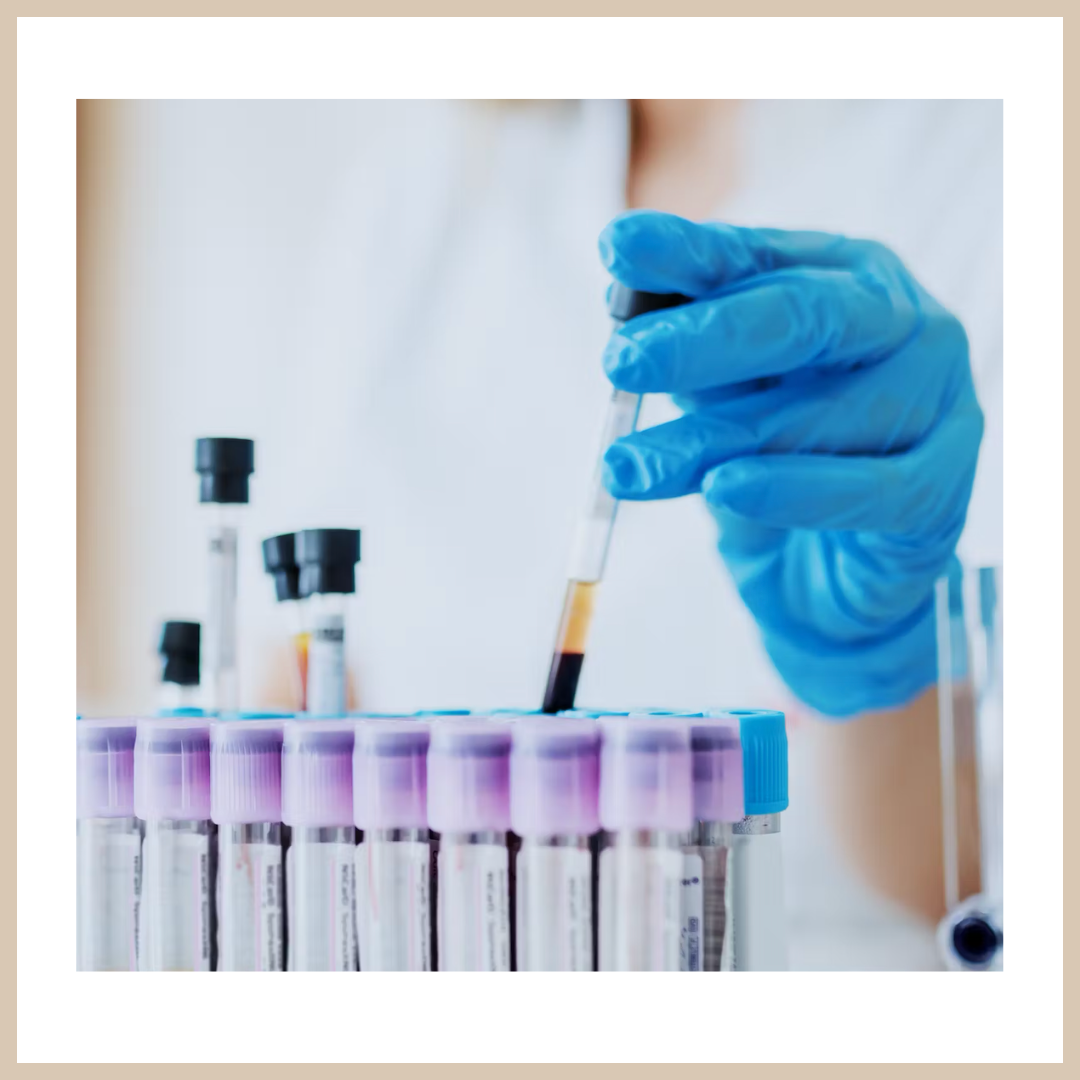 COMPREHENSIVE BLOOD PANEL