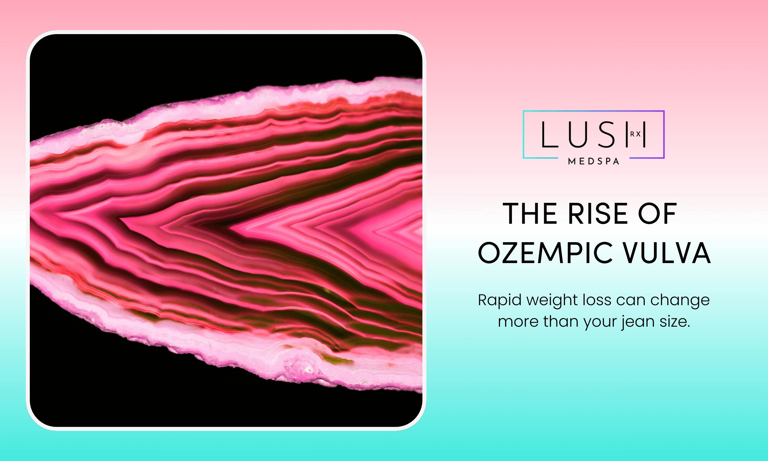 The Rise of Ozempic Vulva (and How to Fix It)