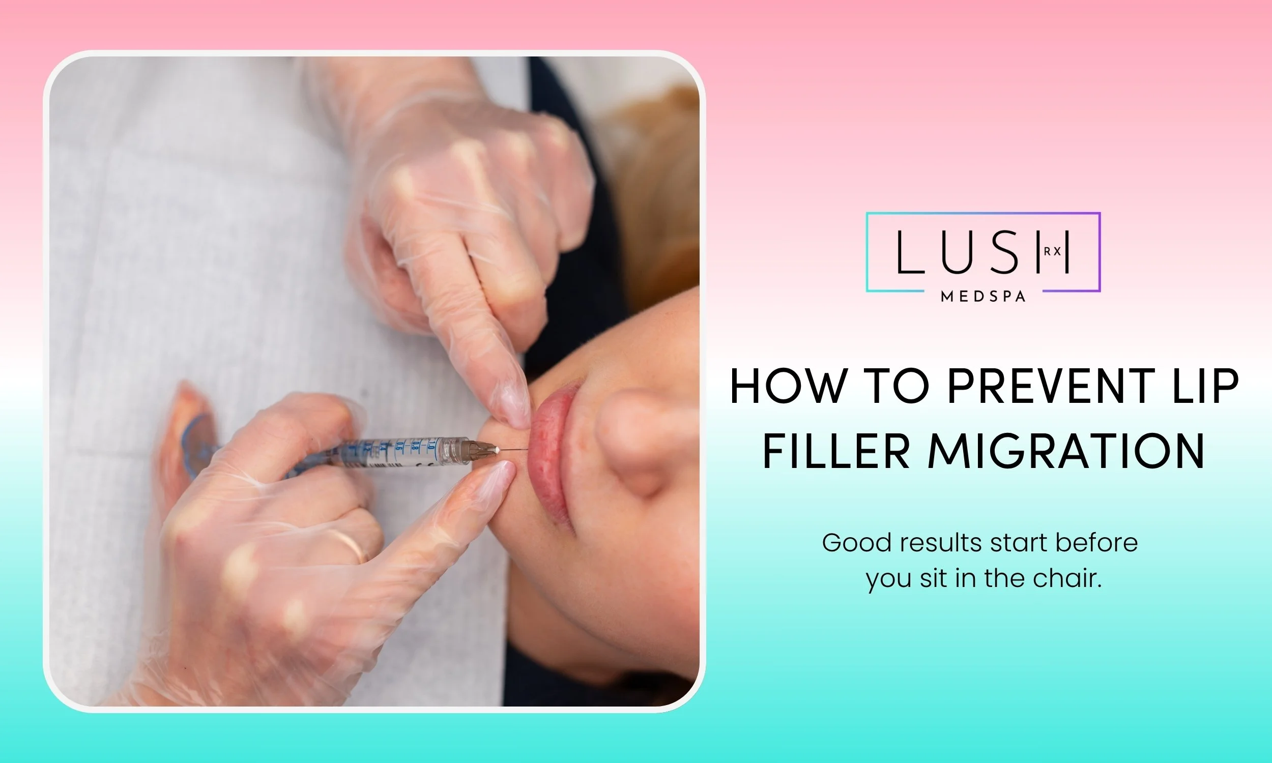 How to Prevent Lip Filler Migration: A Practical Guide