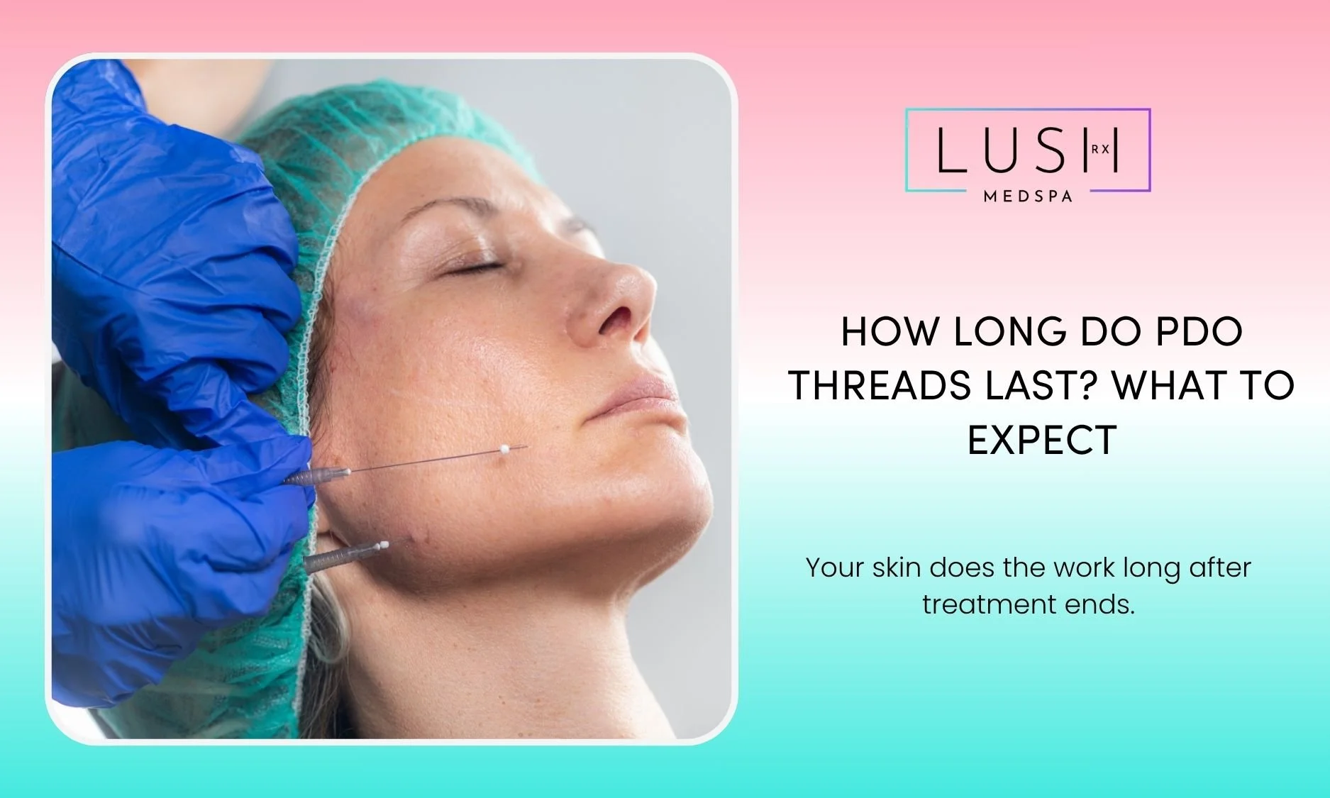 How Long Do PDO Threads Last? What to Expect