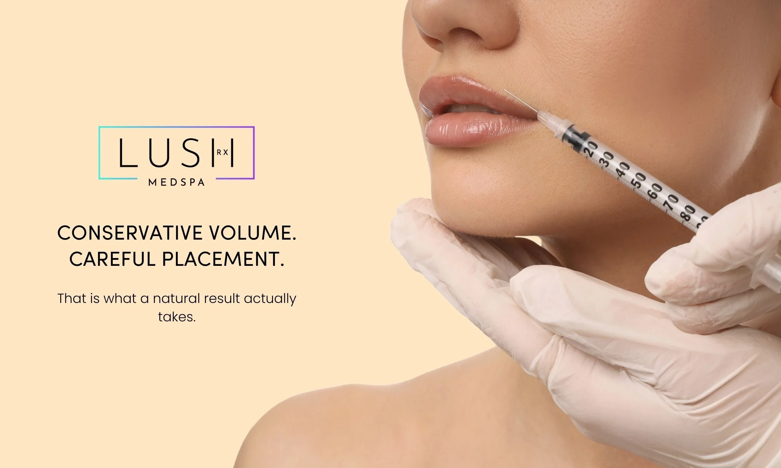 Lip filler that looks natural