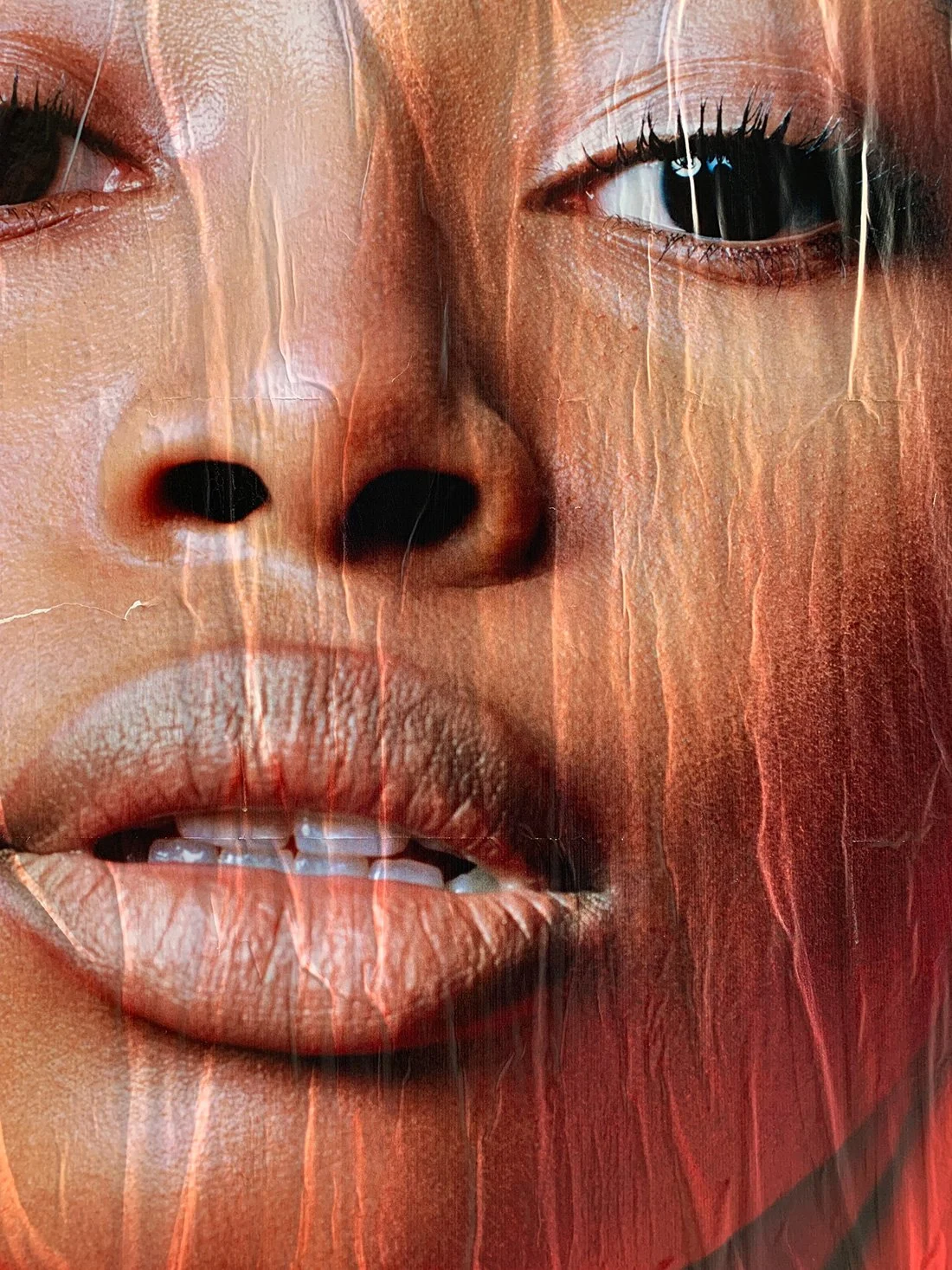 PDO Threads in Houston, TX. Get your non-surgical facelift with Lush RX!