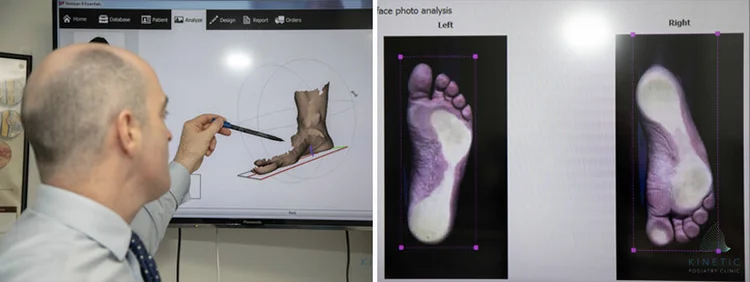 Foot Print/scan 3D Foot Scan — Kinetic Podiatry