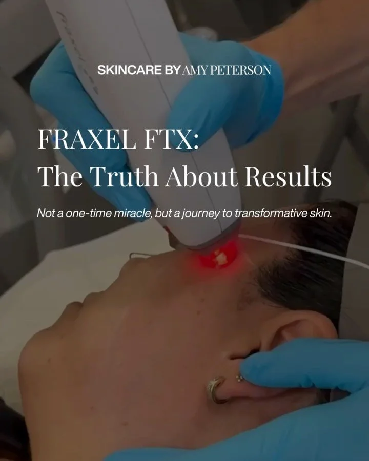 Fraxel FTX isn&rsquo;t a quick fix. It&rsquo;s a skinvestment.

While one treatment can spark visible change, the true transformation happens over a series. Each session builds upon the last, layering in collagen renewal and refining tone, texture, a