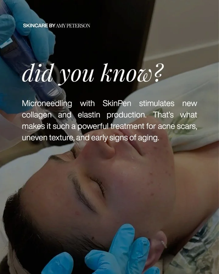 SkinPen microneedling works beneath the surface to stimulate new collagen and elastin &mdash; refining texture, softening acne scars, and addressing early signs of aging. ✨

Consistency is key to transformation. Sign up for the Collagen Club to get s